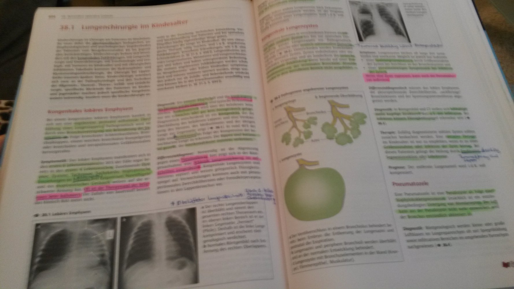 Chirurgie Schnitt für Schnitt inkl. CD-ROM