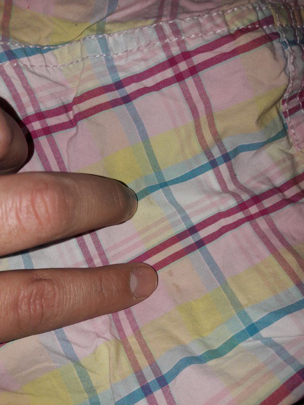 kurze Hose 86 3 kleinere Flecke hinten rechte Seite